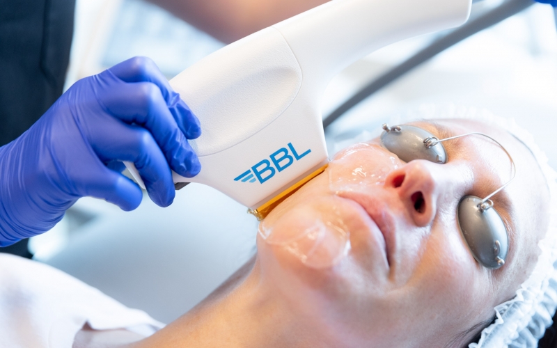 Konya BBL Hero, BBL Hero Uygulaması Konya, BBL Konya, Konya BBL Uygulaması için Uzm. Dr. Ayça Tuğrul Estetik Dermatoloji kliniğinden randevu alabilirsiniz.