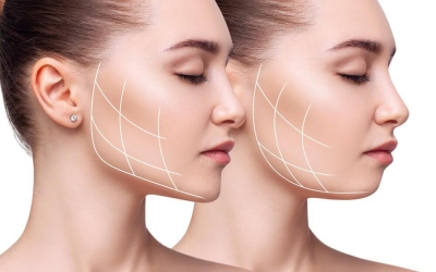 Konya Çenene Dolgusu: Yüz Hatlarında Dengeli ve Estetik Görünüm