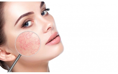 Konya Dermatolog: Cilt Sağlığında Güvenilir ve Uzman Yaklaşım